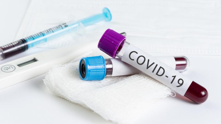 کووید-۱۹ و بارداری: سؤالات متداول در رابطه با کروناویروس جدید در بارداری، زایمان و شیردهی
