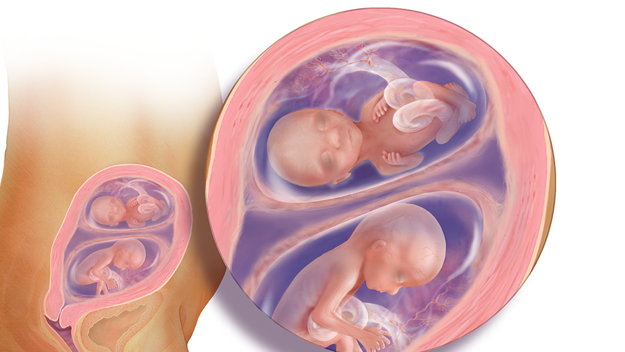 رشد جنین دوقلو در ۱۶ هفتگی