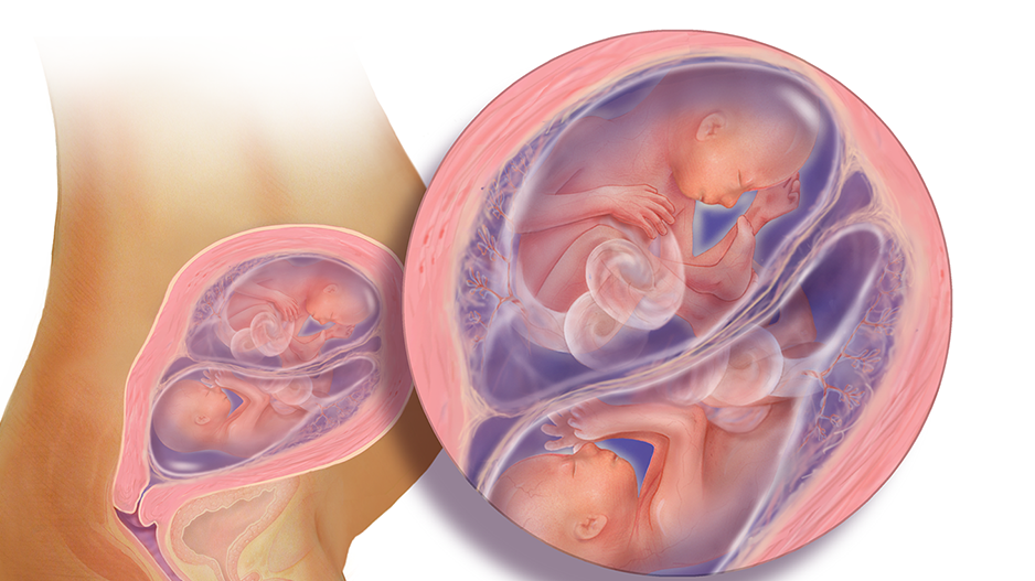 رشد جنین دوقلو در ۲۰ هفتگی