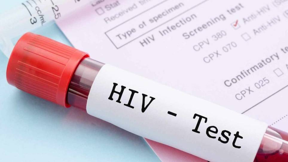 HIV چطور به ایدز تبدیل می‌شود؟