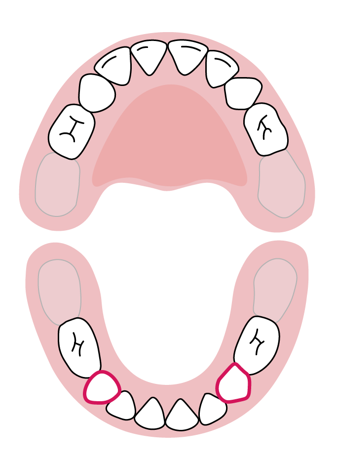 دندان‌های نیش فک پایین: ۱۷ تا ۲۳ ماهگی