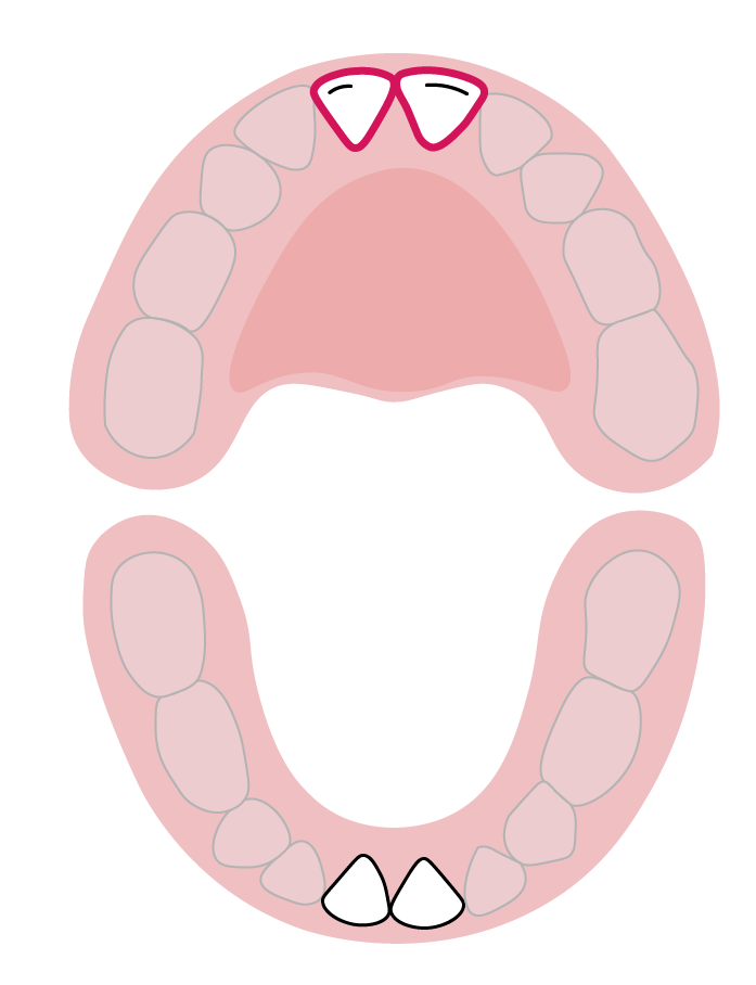 دندان‌های پیش میانی فک بالا: هشت تا ۱۲ ماهگی