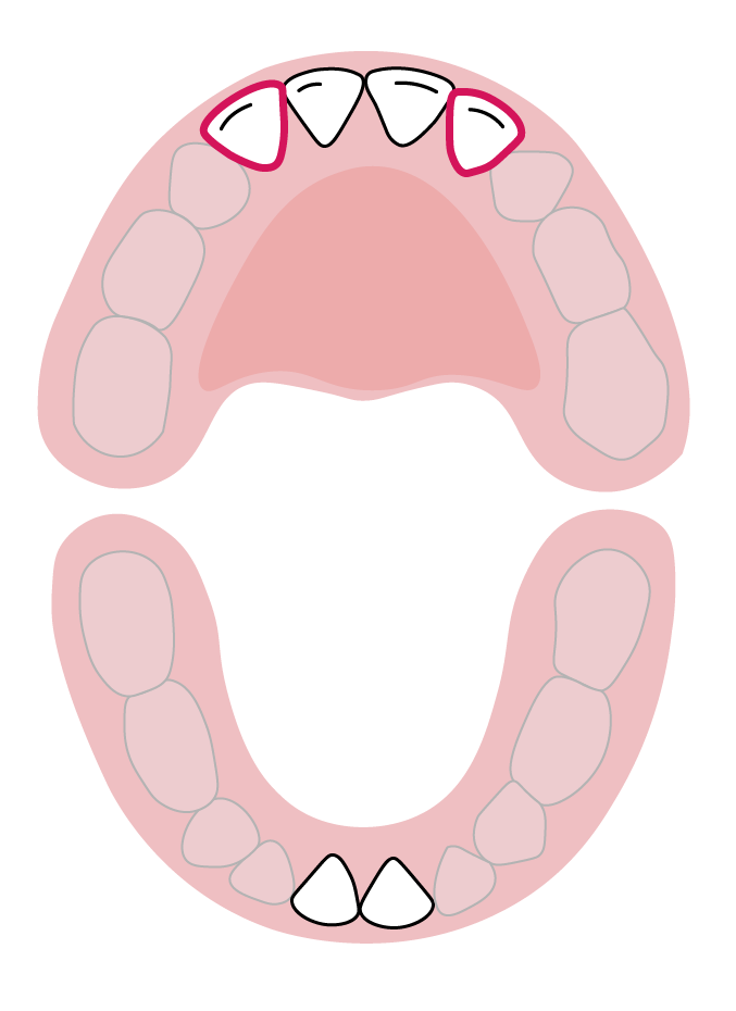 دندان‌های پیش جانبی فک بالا: ۹ تا ۱۳ ماهگی