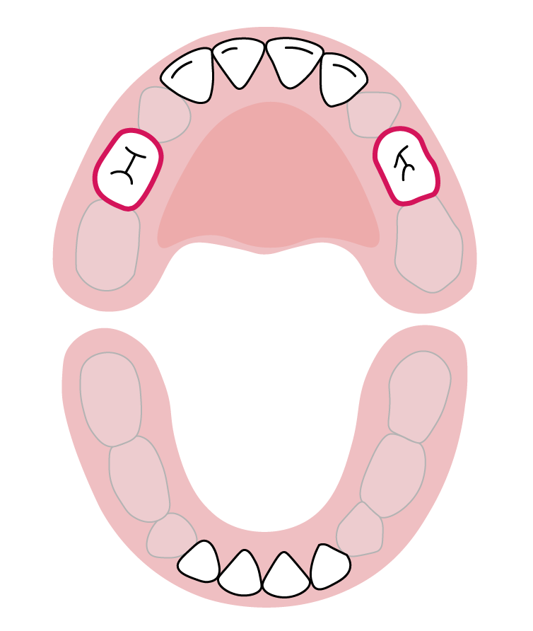 دندان‌های آسیاب اول فک بالا: ۱۳ تا ۱۹ ماهگی