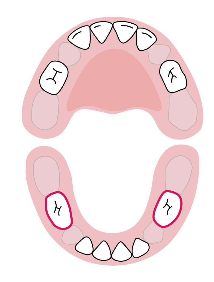 دندان‌های آسیاب اول فک پایین: ۱۴ تا ۱۸ ماهگی