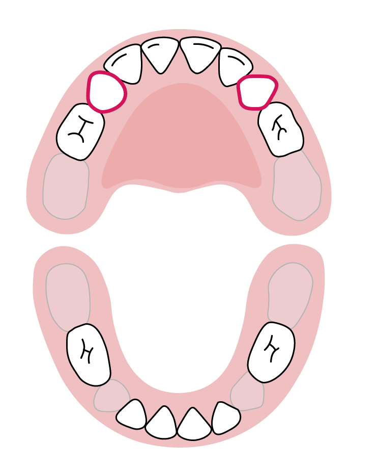 دندان‌های نیش فک بالا: ۱۶ تا ۲۲ ماهگی