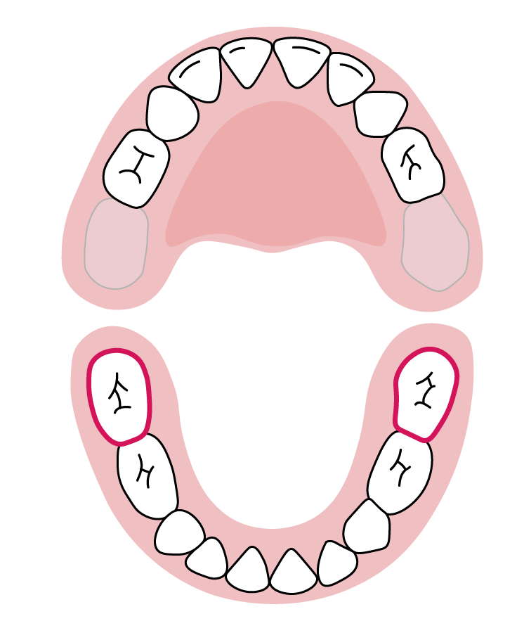 دندان‌های آسیاب دوم فک پایین: ۲۳ تا ۳۱ ماهگی