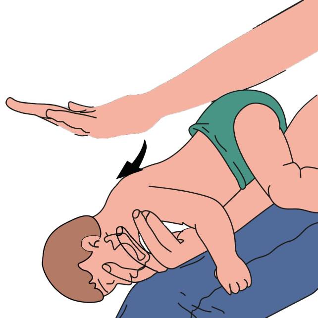 سی پی آر نوزاد
