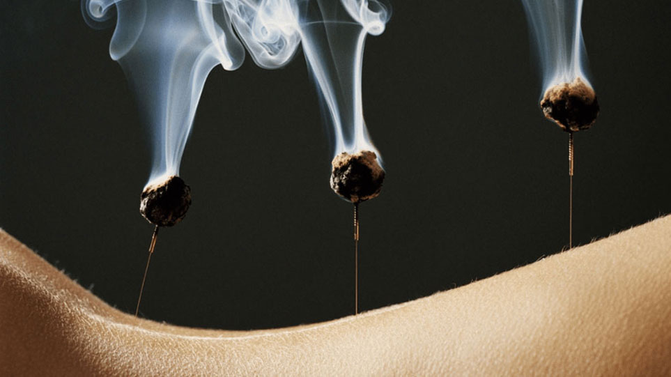 روش موکسی باسشن