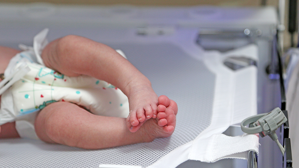 عارضه‌های احتمالی نوزادان زودرس در بخش NICU