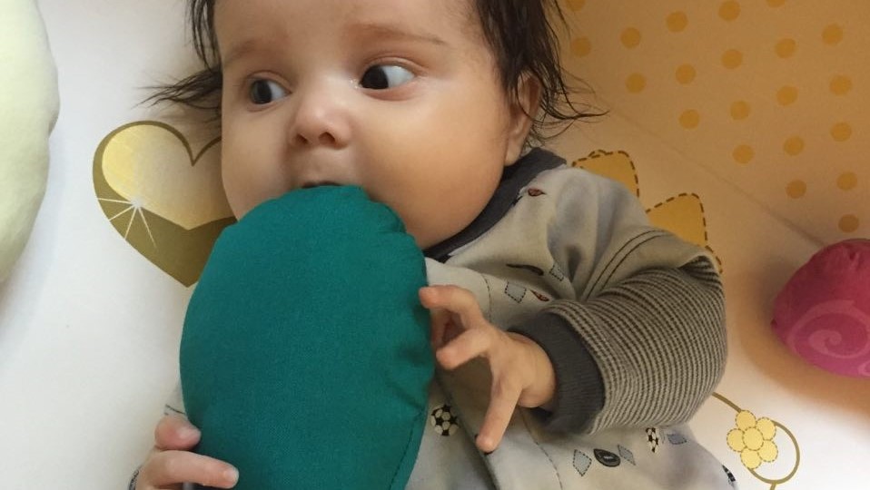 خال‌های گوشتی یا مول‌ در کودکان