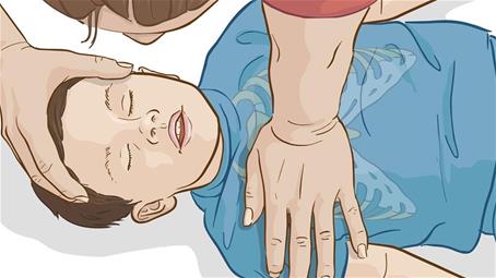 احیای قلبی تنفسی یا CPR در کودکان بزرگ‌تر از یک سال