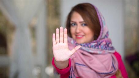 چطور با دستهای خودم جلوی سرطان پستان را بگیرم؟